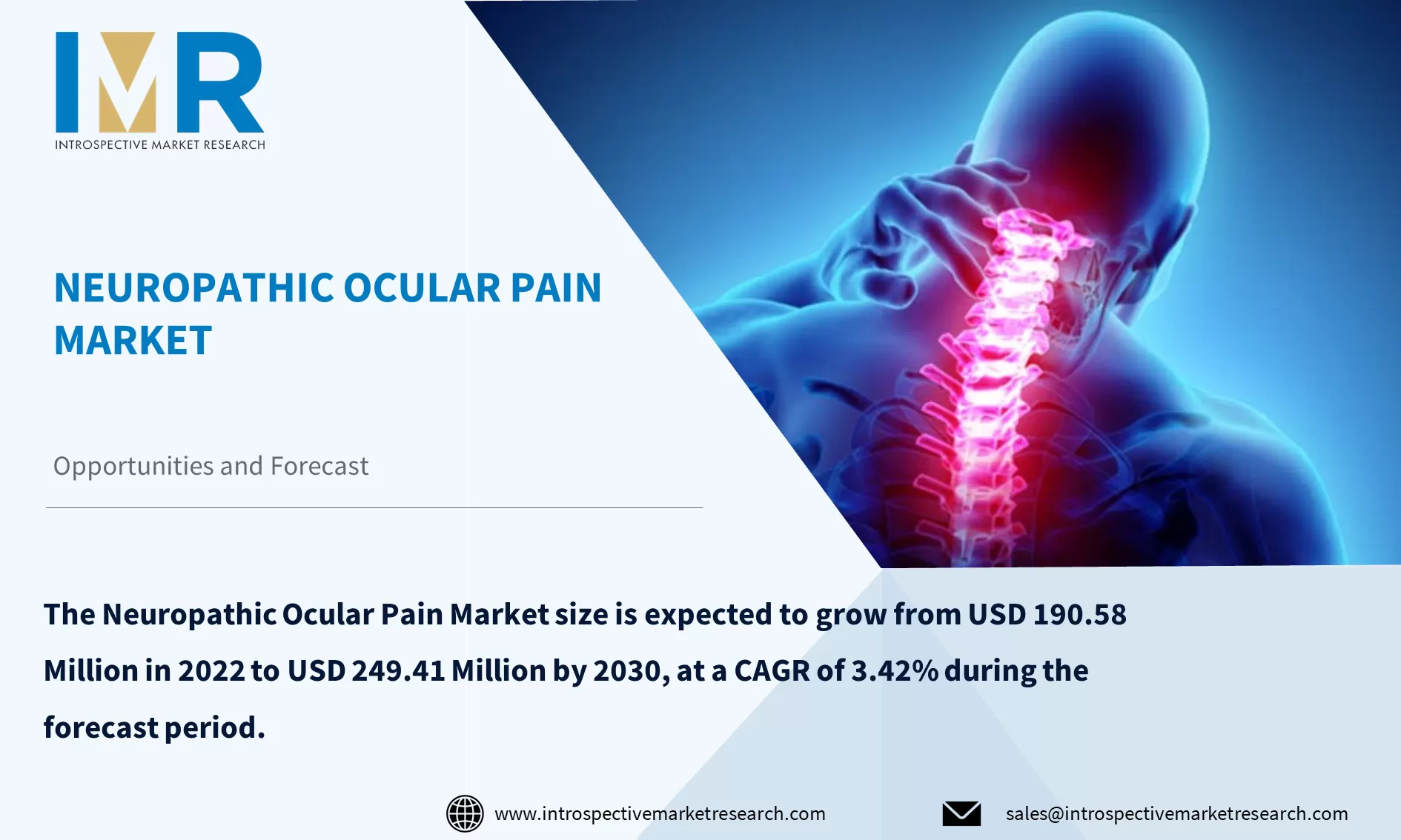 Neuropathic Ocular Pain Market To Reach USD 249.41 Million By Year 2030