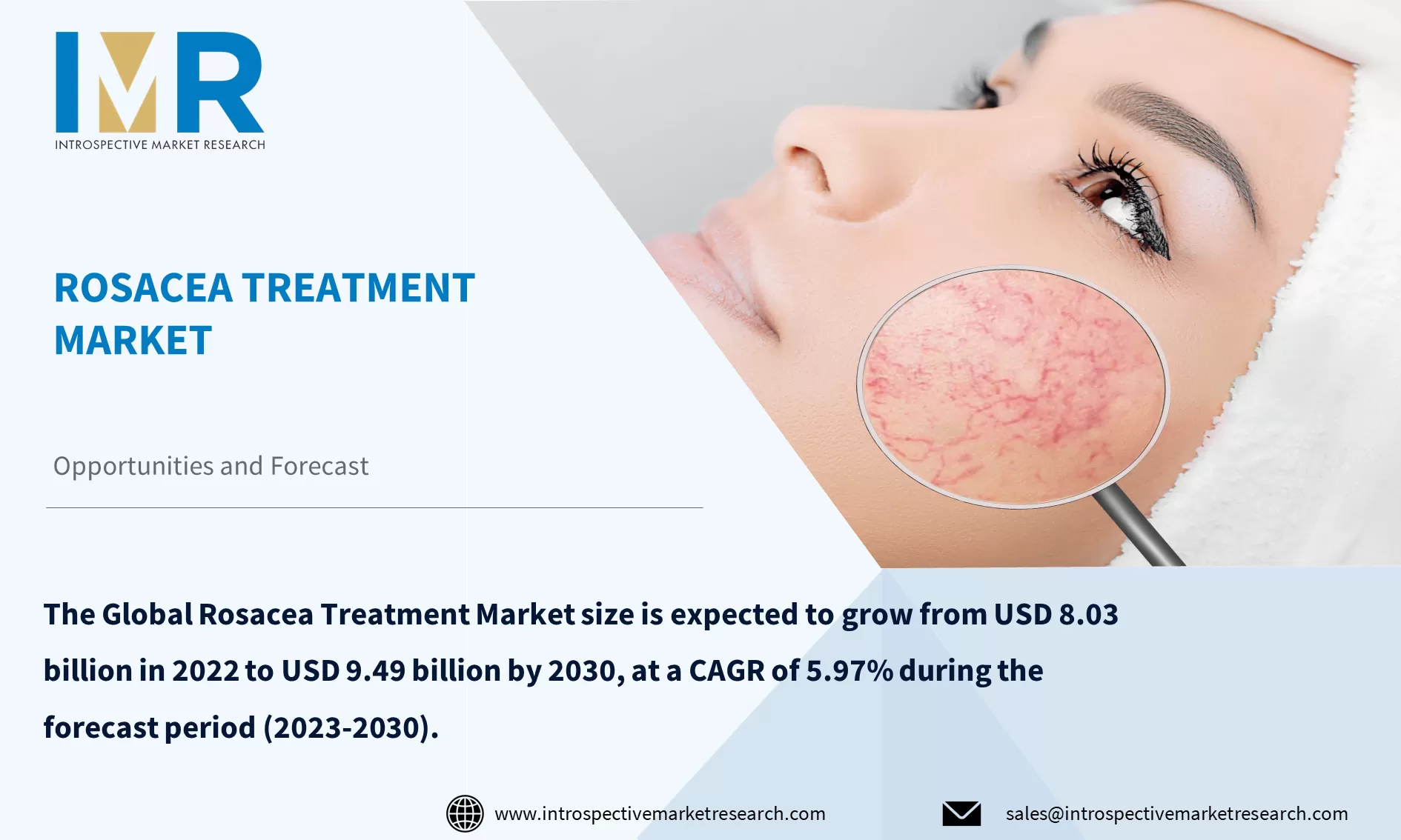 Rosacea Treatment Market To Reach USD 9.49 Billion by Year 2030