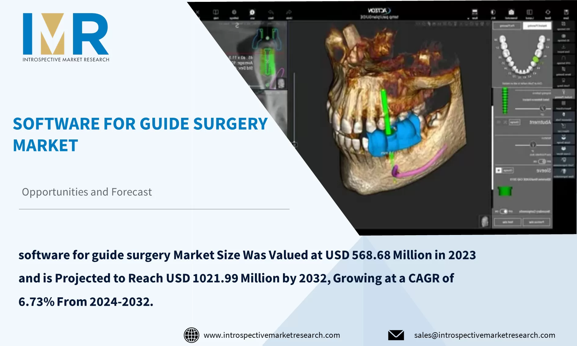 Software for Guide Surgery Market To Reach USD 1021.99 Million By Year 2032