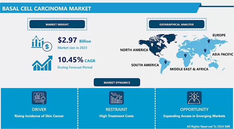 Basal Cell Carcinoma Market - Current Analysis 2024-2032