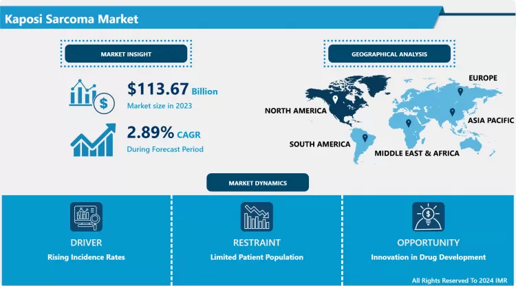 Kaposi Sarcoma Market - Size & Upcoming Industry Trends